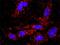 Beta-Secretase 1 antibody, H00023621-M01, Novus Biologicals, Proximity Ligation Assay image 