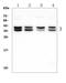 N-acetyltransferase 8-like protein antibody, A07393-2, Boster Biological Technology, Western Blot image 
