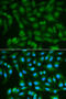 Sorbitol Dehydrogenase antibody, 18-514, ProSci, Immunofluorescence image 