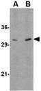 Autophagy Related 12 antibody, GTX31768, GeneTex, Western Blot image 