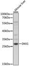 Dickkopf WNT Signaling Pathway Inhibitor 1 antibody, 18-713, ProSci, Western Blot image 