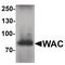 WW Domain Containing Adaptor With Coiled-Coil antibody, PA5-34536, Invitrogen Antibodies, Western Blot image 