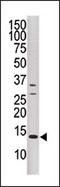 Dual Specificity Phosphatase 15 antibody, AP15280PU-N, Origene, Western Blot image 