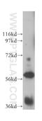 UTP15 Small Subunit Processome Component antibody, 17416-1-AP, Proteintech Group, Western Blot image 
