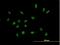 X Antigen Family Member 2 antibody, H00009502-B01P, Novus Biologicals, Immunocytochemistry image 