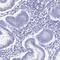 Keratin 17 antibody, HPA045062, Atlas Antibodies, Immunohistochemistry frozen image 
