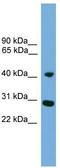 Cardiolipin Synthase 1 antibody, TA331087, Origene, Western Blot image 