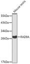RAD9 Checkpoint Clamp Component A antibody, A04161, Boster Biological Technology, Western Blot image 