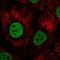 Zinc finger protein basonuclin-1 antibody, HPA063183, Atlas Antibodies, Immunocytochemistry image 