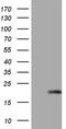 Methylmalonyl-CoA Epimerase antibody, TA808575, Origene, Western Blot image 