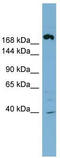 ATP Binding Cassette Subfamily C Member 11 antibody, TA333588, Origene, Western Blot image 