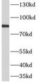 Adenosine Monophosphate Deaminase 3 antibody, FNab00372, FineTest, Western Blot image 