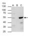 Transcription Factor AP-2 Alpha antibody, GTX113564, GeneTex, Immunoprecipitation image 