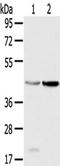 Hydroxysteroid 11-Beta Dehydrogenase 2 antibody, TA351267, Origene, Western Blot image 