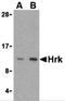 Harakiri, BCL2 Interacting Protein antibody, 3771, ProSci, Western Blot image 