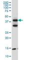 Filamin Binding LIM Protein 1 antibody, H00054751-M10, Novus Biologicals, Western Blot image 