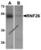 Ring Finger Protein 26 antibody, 8549, ProSci Inc, Western Blot image 