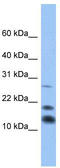Nuclear nucleic acid-binding protein C1D antibody, TA339699, Origene, Western Blot image 