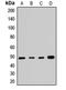 SET and MYND domain-containing protein 3 antibody, LS-C668298, Lifespan Biosciences, Western Blot image 