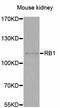 RB Transcriptional Corepressor 1 antibody, STJ25306, St John