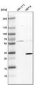 D-beta-hydroxybutyrate dehydrogenase, mitochondrial antibody, HPA030947, Atlas Antibodies, Western Blot image 