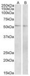 Vasoactive Intestinal Peptide Receptor 1 antibody, AP32928PU-N, Origene, Western Blot image 