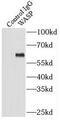 WASP antibody, FNab09471, FineTest, Immunoprecipitation image 