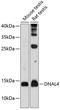 Dynein Axonemal Light Chain 4 antibody, 14-316, ProSci, Western Blot image 