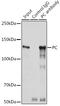 PCB antibody, GTX54577, GeneTex, Immunoprecipitation image 