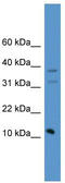 Presenilin Enhancer, Gamma-Secretase Subunit antibody, TA342614, Origene, Western Blot image 