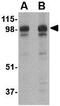 SLIT And NTRK Like Family Member 2 antibody, GTX16999, GeneTex, Western Blot image 