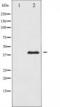 Mitogen-Activated Protein Kinase Kinase 3 antibody, TA325640, Origene, Western Blot image 