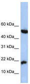 LOC285033 antibody, TA334971, Origene, Western Blot image 