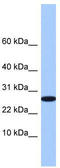 Refilin A antibody, TA337588, Origene, Western Blot image 