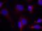 Zeta Chain Of T Cell Receptor Associated Protein Kinase 70 antibody, orb14873, Biorbyt, Immunofluorescence image 