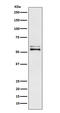 Angiotensinogen antibody, M02103-2, Boster Biological Technology, Western Blot image 
