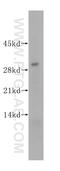 SGP28 antibody, 14847-1-AP, Proteintech Group, Western Blot image 