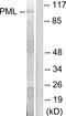 Promyelocytic Leukemia antibody, LS-C118558, Lifespan Biosciences, Western Blot image 
