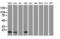 Destrin antibody, LS-C172797, Lifespan Biosciences, Western Blot image 
