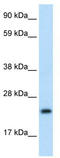 Achaete-Scute Family BHLH Transcription Factor 1 antibody, TA330265, Origene, Western Blot image 