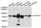 UDP Glucuronosyltransferase Family 1 Member A1 antibody, A1359, ABclonal Technology, Western Blot image 