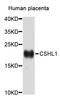 Chorionic Somatomammotropin Hormone Like 1 antibody, STJ26487, St John