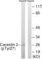Caveolin 2 antibody, LS-C198742, Lifespan Biosciences, Western Blot image 