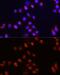 Activin A Receptor Type 2A antibody, GTX64724, GeneTex, Immunofluorescence image 