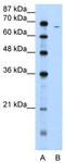 Human Fibrinogen antibody, TA346201, Origene, Western Blot image 