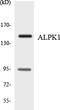 Alpha Kinase 1 antibody, LS-C200119, Lifespan Biosciences, Western Blot image 