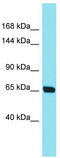 Centrosomal Protein 104 antibody, TA337377, Origene, Western Blot image 