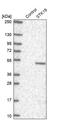 Serine/threonine-protein kinase 19 antibody, PA5-56765, Invitrogen Antibodies, Western Blot image 