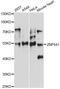 Zinc Finger Protein 641 antibody, LS-C749438, Lifespan Biosciences, Western Blot image 