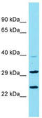 Putative uncharacterized protein C9orf106 antibody, TA334918, Origene, Western Blot image 